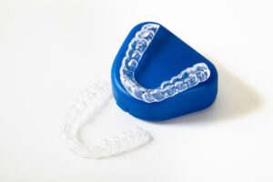 Aligners vs. Traditional Braces: Which Is Right for You?